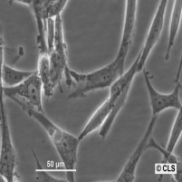 U-118 MG细胞图片